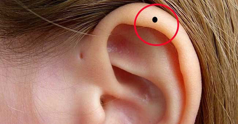 Nốt ruồi ở vành tai ở nữ giới và nam giới mang ý nghĩa gì? Là phúc hay họa?