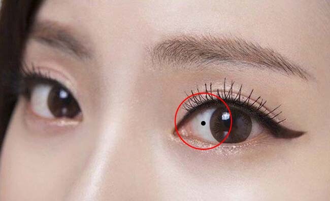 Nốt ruồi trong mắt là gì? Ý nghĩa của nốt ruồi có vị trí đặc biệt